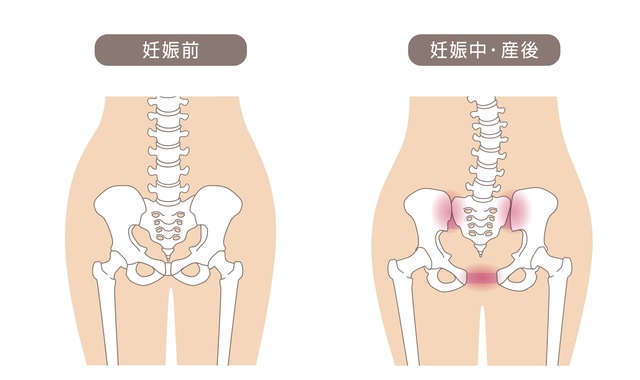 骨盤